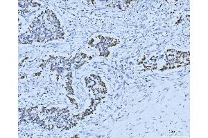IHC analysis of MCM6 using anti-MCM6 antibody (ABIN7600037). (MCM6 Antikörper  (AA 14-821))