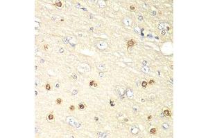 Immunohistochemistry (Paraffin-embedded Sections) (IHC (p)) image for anti-Hypoxia Inducible Factor 1, alpha Subunit Inhibitor (HIF1AN) (AA 1-349) antibody (ABIN6141762)