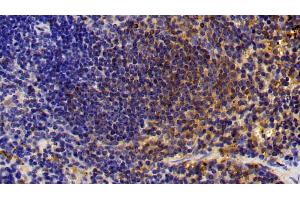 Detection of CTSS in Mouse Spleen Tissue using Polyclonal Antibody to Cathepsin S (CTSS) (Cathepsin S Antikörper  (AA 115-331))