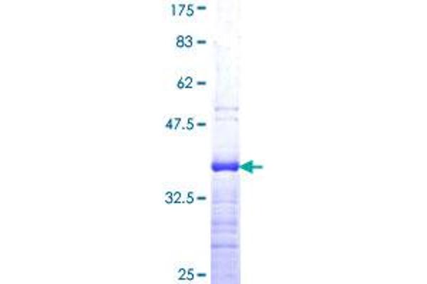 KLF5 Protein (AA 358-457) (GST tag)
