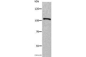 Western blot analysis of Human fetal brain tissue, using ADAMTS5 Polyclonal Antibody at dilution of 1:650 (ADAMTS5 Antikörper)