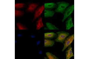 ABIN6259851 and ABIN6278727 staining  cells by IF/ICC. (AKAP12 Antikörper  (C-Term))
