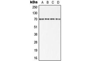 Western blot analysis of cIAP1 expression in HT29 (A), Jurkat (B), SP2/0 (C), PC12 (D) whole cell lysates.