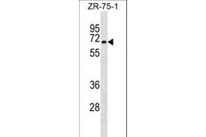 SG Antibody (C-term) (ABIN1537484 and ABIN2849754) western blot analysis in ZR-75-1 cell line lysates (35 μg/lane). (C9orf96 Antikörper  (C-Term))