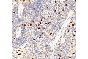 Immunohistochemistry (Paraffin-embedded Sections) (IHC (p)) image for anti-Interleukin-27 Subunit alpha (IL27) antibody (ABIN7074367)
