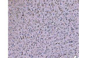 IHC analysis of DLAT using anti-DLAT antibody (ABIN7602307). (DLAT Antikörper  (AA 69-642))