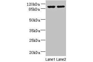 Western blot All lanes: EFHB antibody at 4 μg/mL Lane 1: HepG2 whole cell lysate Lane 2: PC-3 whole cell lysate Secondary Goat polyclonal to rabbit IgG at 1/10000 dilution Predicted band size: 94, 71, 80 kDa Observed band size: 94 kDa (EFHB Antikörper  (AA 405-644))