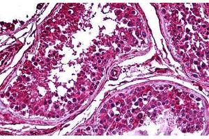 Human Testis: Formalin-Fixed, Paraffin-Embedded (FFPE) (PDK2 Antikörper  (AA 187-276))