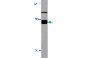 Western blot analysis of EEF2K polyclonal antibody  in extracts from HeLa cells at 1:500 dilution.