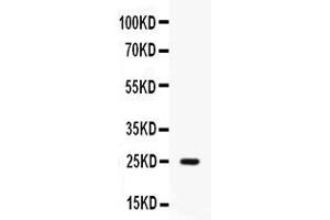 Western blot analysis of Elafin/Skalp expression in human placenta extract ( Lane 1). (PI3 Antikörper  (AA 61-117))