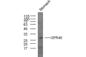Mouse stomach lysates probed with GPR40 Polyclonal Antibody, unconjugated  at 1:300 overnight at 4°C followed by a conjugated secondary antibody at 1:10000 for 60 minutes at 37°C. (FFAR1 Antikörper  (AA 121-220))