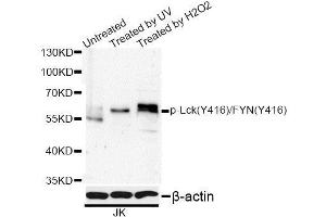Western blot analysis of extracts of Jurkat cells, using Phospho-Lck-Y416/FYN-Y416 antibody (ABIN5995591) at 1/1000 dilution. (LCK Antikörper  (pTyr416))