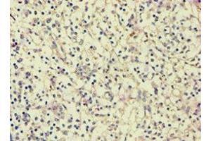 Immunohistochemistry (IHC) image for anti-Angiogenic Factor with G Patch and FHA Domains 1 (AGGF1) (AA 1-70) antibody (ABIN7144082)