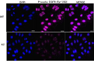 Immunocytochemical staining of HepG2 cells using Phospho-EGFR (Tyr) antibody (ABIN7798465), 1:1,000), Top panel: wild-type (WT), Bottom panal: Phospho-EGFR (Tyr) shRNA knockdown (KD).