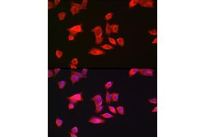 Immunofluorescence analysis of Hep G2 cells using GAMT Rabbit pAb (ABIN6130447, ABIN6140950, ABIN6140951 and ABIN6222280) at dilution of 1:200 (40x lens). (GAMT Antikörper  (AA 1-236))
