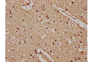 IHC image of ABIN7163520 diluted at 1:100 and staining in paraffin-embedded human brain tissue performed on a Leica BondTM system. (ATP2B4 Antikörper  (AA 281-345))