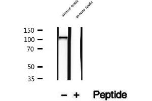 Western blot analysis of extracts of mouse testis tissue, using NAT10 antibody. (NAT10 Antikörper  (Internal Region))