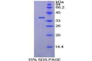 SDS-PAGE (SDS) image for Apoptosis Antagonizing Transcription Factor (AATF) protein (ABIN3008386)