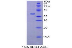 SDS-PAGE analysis of Rat AATF Protein.