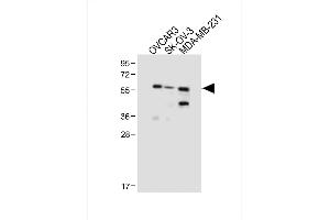 All lanes : Anti-HR2 Antibody (N-term) at 1:1000 dilution Lane 1: OVCAR3 whole cell lysate Lane 2: SK-OV-3 whole cell lysate Lane 3: MDA-MB-231 whole cell lysate Lysates/proteins at 20 μg per lane. (AMHR2 Antikörper  (N-Term))