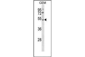 Western blot analysis of P2RY2 / P2Y2 Antibody (C-term) in CEM cell line lysates (35ug/lane). (P2RY2 Antikörper  (C-Term))