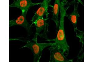 ICC/IF staining of HeLa cells treated with sodium butyrate using recombinant H3K56ac antibody (red). (Rekombinanter Histone 3 Antikörper  (H3K56ac))