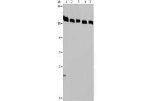 Western Blotting (WB) image for anti-Importin 4 (IPO4) antibody (ABIN2423661) (Importin 4 Antikörper)