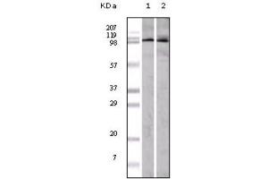 Western blot analysis using EphA1 antibody against A549 (1) and Hela (2) cell lysate. (EPHA1 Antikörper)