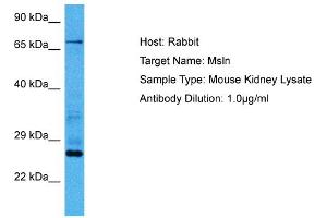 Host:  Mouse  Target Name:  MSLN  Sample Tissue:  Mouse Kidney  Antibody Dilution:  1ug/ml (Mesothelin Antikörper  (Middle Region))