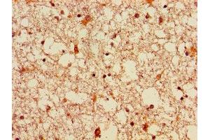 Immunohistochemistry of paraffin-embedded human brain tissue using ABIN7152811 at dilution of 1:100 (FGF22 Antikörper  (AA 23-170))