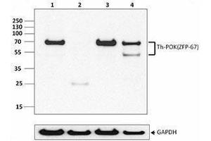 Western Blotting (WB) image for anti-Th-POK antibody (ABIN2665409) (Th-POK Antikörper)