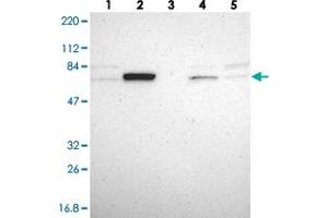 Western blot analysis of Lane 1: RT-4, Lane 2: U-251 MG, Lane 3: Human Plasma, Lane 4: Liver, Lane 5: Tonsil with GRHL1 polyclonal antibody  at 1:250-1:500 dilution. (GRHL1 Antikörper)