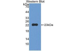 Western Blotting (WB) image for anti-Matrix Metallopeptidase 12 (Macrophage Elastase) (MMP12) (AA 294-473) antibody (ABIN1172854) (MMP12 Antikörper  (AA 294-473))