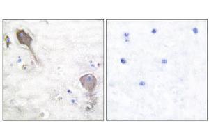 Immunohistochemistry (IHC) image for anti-Parkinson Protein 2, E3 Ubiquitin Protein Ligase (Parkin) (PARK2) (N-Term) antibody (ABIN1848726) (Parkin Antikörper  (N-Term))
