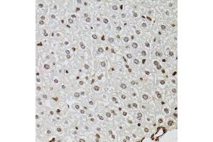 Immunohistochemistry of paraffin-embedded mouse liver using KDM4A antibody (ABIN6131821, ABIN6142793, ABIN6142795 and ABIN6223960) at dilution of 1:100 (40x lens). (KDM4A Antikörper  (AA 585-815))