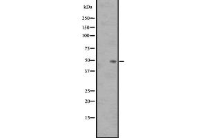 Western blot analysis of SS3R expression in Fetal Kidney Lysate,The lane on the left is treated with the antigen-specific peptide.