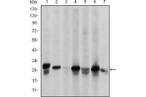 Western blot analysis using HSP27 mouse mAb against Hela (1), A549 (2), Jurkat (3), A431 (4), HEK293(5), HepG2 (6) and PC-12 (7) cell lysate. (HSP27 Antikörper)