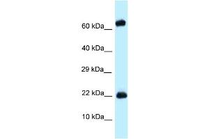 WB Suggested Anti-Zfp580 Antibody Titration: 1. (ZNF580 Antikörper  (Middle Region))