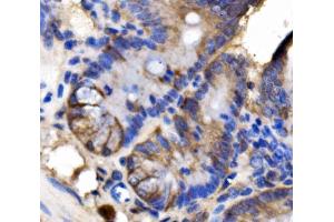 IHC analysis of LSR using anti-LSR antibody (ABIN7599514). (LSR Antikörper  (AA 1-649))