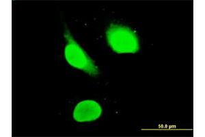 Immunofluorescence of monoclonal antibody to IKZF3 on HeLa cell.