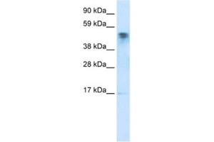 Western Blotting (WB) image for anti-FLJ13798 (FLJ13798) antibody (ABIN2460760)