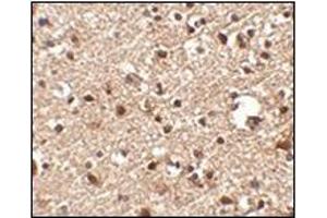 Immunohistochemistry of JPH4 in human brain tissue with this product at 2. (Junctophilin 4 Antikörper  (C-Term))