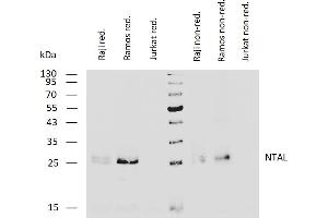 Western blotting analysis of human NTAL using mouse monoclonal antibody NAP-07 on lysates of Raji and Ramos cells and on Jurkat cells (negative control) under reducing and non-reducing conditions. (LAT2 Antikörper  (Cytoplasmic Domain))
