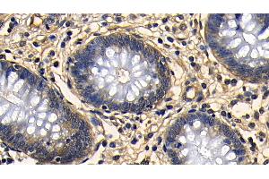 Immunohistochemistry (IHC) image for anti-Transforming Growth Factor, beta 1 (TGFB1) (AA 279-390) antibody (ABIN7429469)