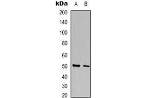 Western blot analysis of AGXT2L2 expression in HepG2 (A), A431 (B) whole cell lysates.