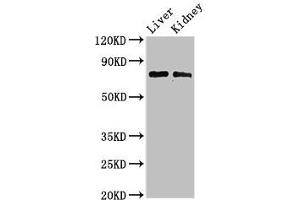 Western Blot Positive WB detected in: Mouse liver tissue, Mouse kidney tissue All lanes: PHF21A antibody at 3 μg/mL Secondary Goat polyclonal to rabbit IgG at 1/50000 dilution Predicted band size: 75, 71 kDa Observed band size: 75 kDa (PHF21A Antikörper  (AA 312-487))