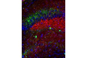 anti-Vesicle-Associated Membrane Protein 7 (VAMP7) (AA 119-188) antibody
