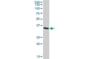 MDH1 monoclonal antibody (M01), clone 2B11-B7.