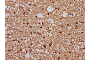 IHC image of ABIN7171666 diluted at 1:300 and staining in paraffin-embedded human brain tissue performed on a Leica BondTM system. (Tiparp Antikörper  (AA 74-178))
