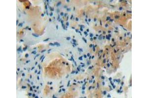 IHC-P analysis of lung tissue, with DAB staining. (DOCK2 Antikörper  (AA 390-635))